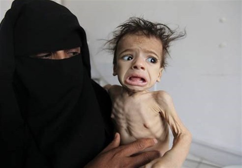 UN: Yemen on brink of 'world's worst famine in 100 years’