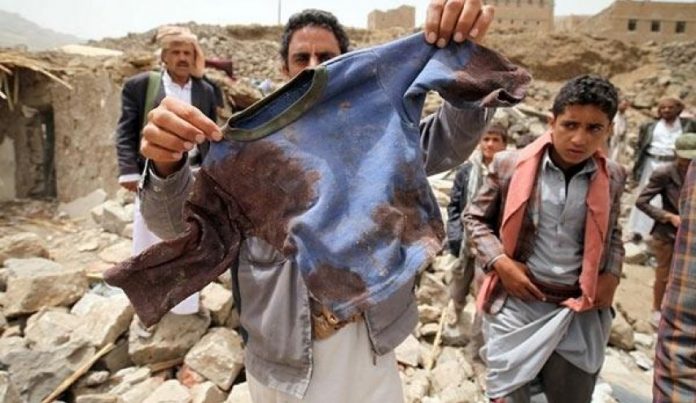 Exacerbating bombing of Yemeni residential areas, ‘sign of desperation of intruders’