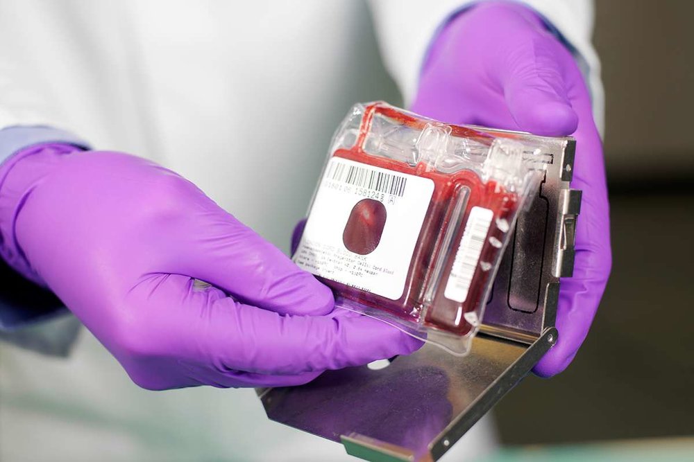 Iran home to largest cord blood bank in Middle East