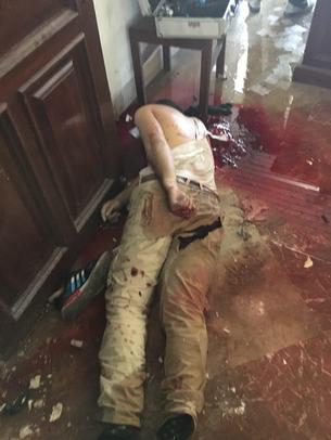 جسد تروریست به هلاکت رسیده در مجلس