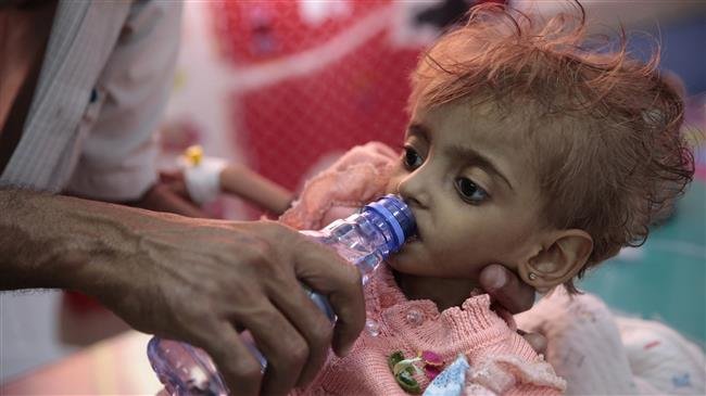World responsible for ending human catastrophe in Yemen: Iran
