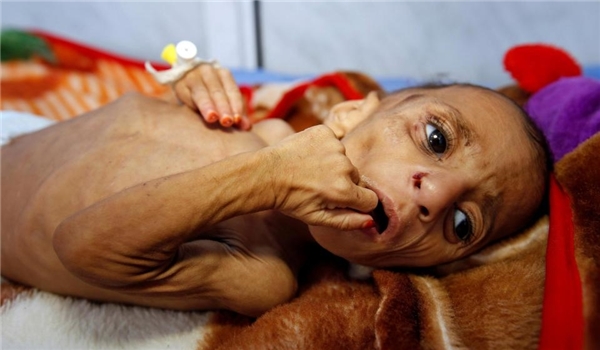 Iran Blasts US, Britain, France for Massacre of Yemeni Women, Children