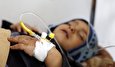 No Legal or Moral Justification for Yemen Suffering