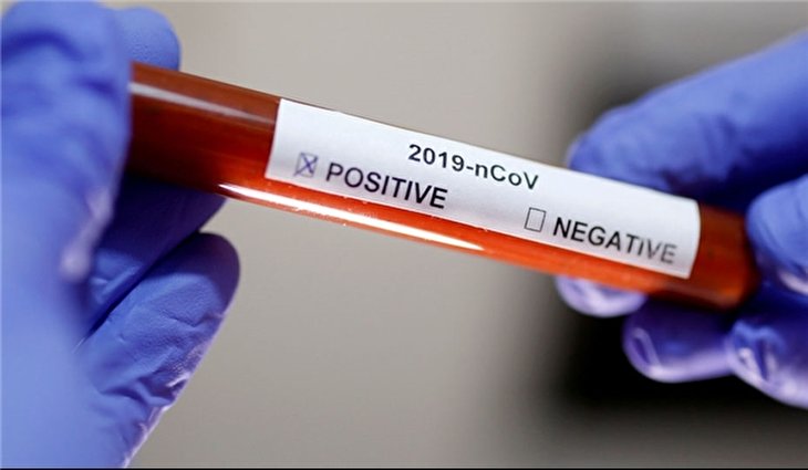 Iran Unveils Advanced Test Kit Able to Detect Coronavirus in 3 Hours