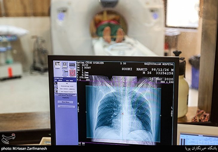 Iran Unveils AI-Assisted Software for COVID-19 Diagnosis