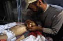 تصاویری دلخراش از شهدا و مجروحان فلسطینی
