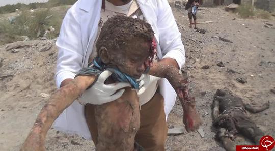 به دنبال هجوم جنگنده‌های ائتلاف سعودی به شهر الحدیده یمن چندین تن به شهادت رسیدند و شماری نیز در وضعیتی وخیم به سر می‌برند.