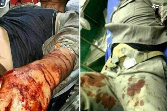 اصغر بذرافشان محیط‌بان رامیان استان گلستان بر اثر شلیک شکارچی غیرمجاز از ناحیه دست چپ مجروح و برای مداوا به بیمارستان انتقال داده شد.
