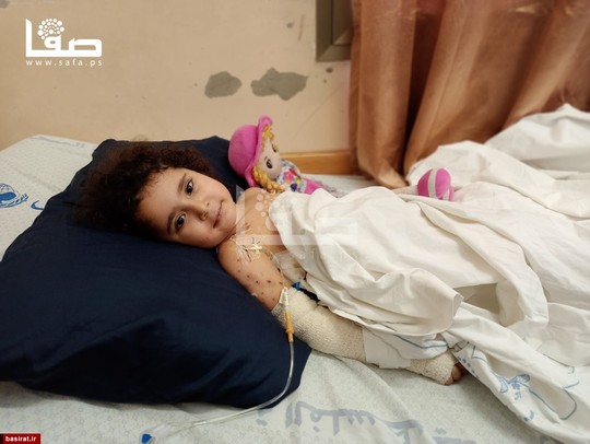 کودک مجروح فلسطینی که در حملات 11 روزه رژیم صهیونیستی حرکت پاهای خود را از دست داده است