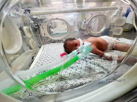 نوزادان نارس در بیمارستان پزشکی ناصر در خان یونس به دلیل محاصره و بسته شدن گذرگاه‌های غزه در وضعیت خطرناکی به سر می‌برند.