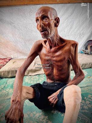 تاثیرات گرسنگی بر موذن مسجد صحابه در جنوب غزه
