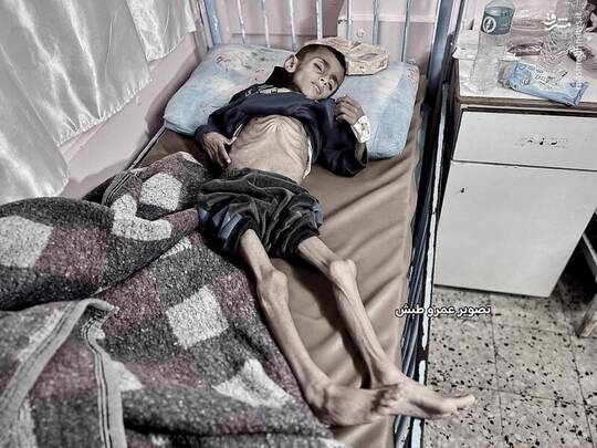 تصاویر تازه از نوار غزه که اکنون جهان به‌طور رسمی وضعیت قحطی را در آن اعلام کرده، صحنه‌هایی دلخراش از رنج کودکان فلسطینی به نمایش می‌گذارد.