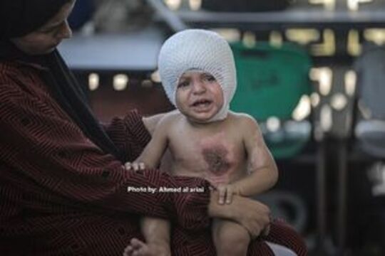 محمد حجیل کودک یک‌ساله فلسطینی بر اثر حمله هوایی نیروهای اشغالگر اسرائیلی به نوار غزه دچار سوختگی‌های شدید شده است.