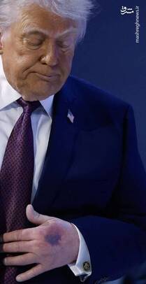 تصویر دست ترامپ در حاشیه داووس
